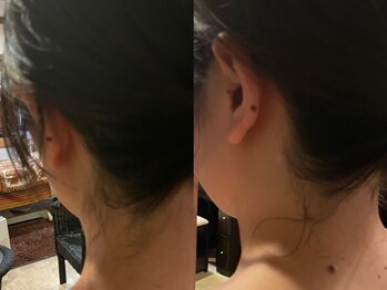 アスエール(usyell)の写真/挙式前の産毛処理と角質除去で、ツルスベ美肌に.*フェイシャルシェービング40分¥4000[痩身/シェービング]