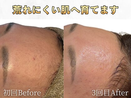 芯美 恵比寿店(shinbi)の写真