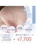 【初回限定】贅沢!高濃度美容液導入♪毛穴矯正フェイシャル¥16,500→¥7,700