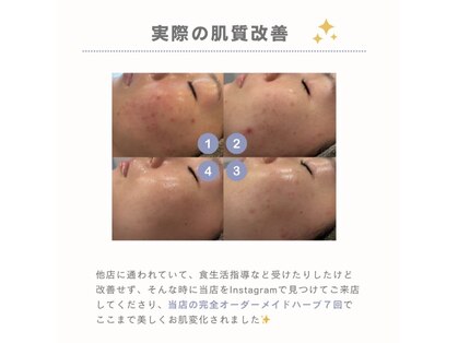 クレセント(CRESCENT)の写真