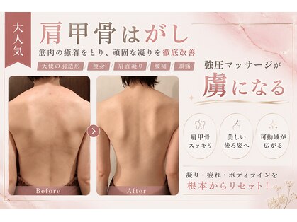 二の腕＆背中　Barbie Glow 恵比寿【ブライダル/痩身/フェイシャル/グリーンピール】の写真