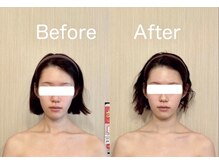 サロン ド シャルール/一回の施術結果