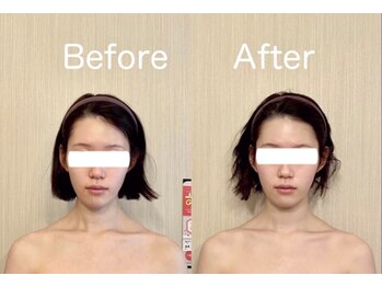 サロン ド シャルール/一回の施術結果