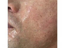 カルディエ(Cardie)/ポップアップ現象