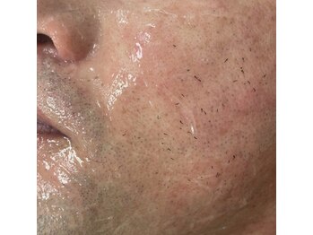 カルディエ(Cardie)/ポップアップ現象