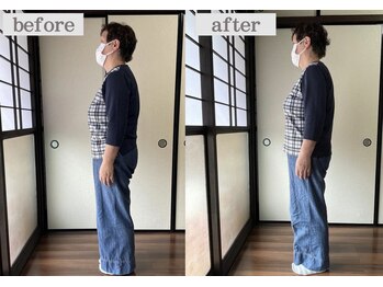 ミントのかべの整体院/姿勢矯正ビフォーアフター