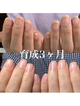 スティラ(Stila)/自爪育成/深爪育成/ネイルケア