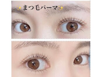 エステサロン リール