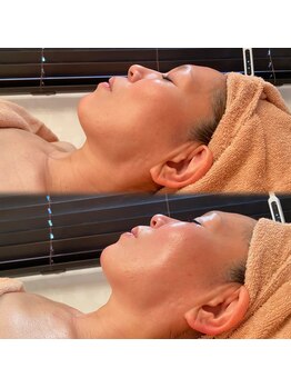 ビューティーサロン キャンディ 海老名(Candy)/