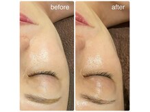 白玉肌を叶える白玉肌管理メニュー多数☆