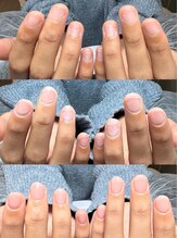 リミズネイルビューティー 名駅店(RimisNailxbeauty)/長さ出し10本付深爪・噛み爪改善
