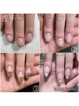 ラモ(RAMO)/ジェルをつけてから半年経過