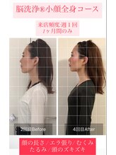 ジェミニ(Gemini)&nbsp;脳洗浄小顔 全身コース