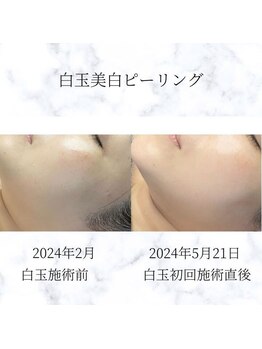 サロン ド メデューズ 札幌店(Salon de meduse)の写真/乾燥やハリ不足を撃退！極上ツヤ肌×小顔ケアで、内側から輝くような理想の素肌美を叶えます！