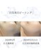 サロン ド メデューズ 札幌店(Salon de meduse)の写真/乾燥やハリ不足を撃退！極上ツヤ肌×小顔ケアで、内側から輝くような理想の素肌美を叶えます！