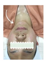 LTサロン グレース(Grace)/フェイスラインすっきり！