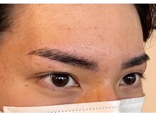 アイブロウマン(i Browman)/施術イメージ