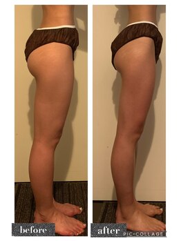 マンダ 田町(Manda)/スラリと伸びた美脚に改善!