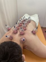 きずな整骨院/吸玉