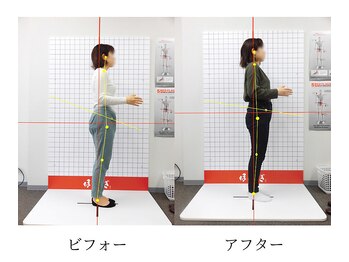 ほねつぎ 平成けやき通り鍼灸接骨院/骨盤矯正ビフォーアフター2
