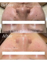 シャルム(Charme.)/