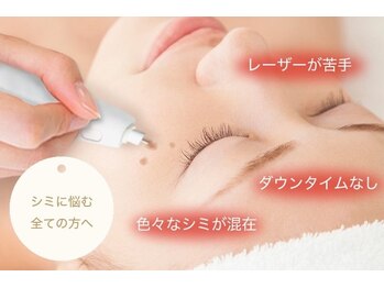 エンボーテ(enbeaute)の写真/【シミ改善】シミが気になる方へ！お肌にやさしいシミケア☆痛みが少なくダウンタイムなし！透明クリア肌に