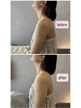 グリッタープラス(glitter plus)/女性らしさのある整った姿勢へ