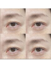 マツエク カハナ 北千住(Kahana)/【まつげパーマ】PEANUTS