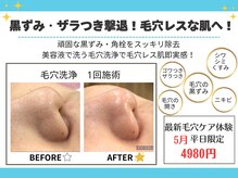 毛穴レスなツヤ肌に♪美容液で洗う毛穴洗浄で毛穴悩みゼロへ！