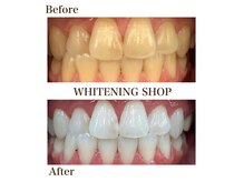 whitening shop 守谷店の雰囲気（ホワイトニングショップ守谷店　セルフホワイトニングサロン）