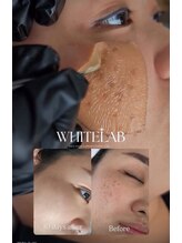 ココノワ(coconoix)/ホワイトラボ