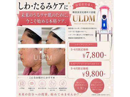 ミーン(miin)の写真