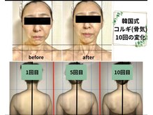 アグレーブル(Agreable)の雰囲気（痛気持ちいい施術でお顔お身体もスッキリ軽やかに整う極上ケア♪）