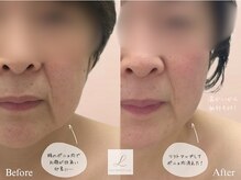 リル ビューティー ラボ(LILU BEAUTY LAB)の雰囲気（もたつき改善にも！LILU独自の施術方法で最短結果！）