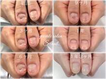エスネイル(S-nail)