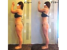 痩身 セル脂肪専門 スタイルデザイン/アラフォー44才綺麗になれます♪