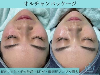 リメイククリニカルビューティー(Remake clinical beauty)/オルチャンパッケージ