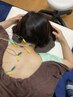 【神経症状でお悩みの方】鍼灸×電気で原因部位にアプローチ♪計60分