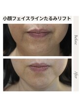 エイジングケア専門サロン サンク(thanq)/小顔・二重あご・フェイスライン