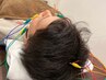 頭痛・眼精疲労にヘッドマッサージ（ヘッドスパ）＋耳ツボマッサージ＋電気鍼