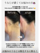 エリス(ELISSE)/自己処理が難しいうなじは…