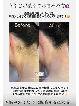 エリス(ELISSE)/自己処理が難しいうなじは…