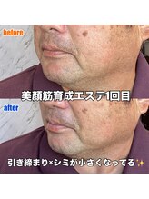 リエル(RIEL)/【美顔筋育成】