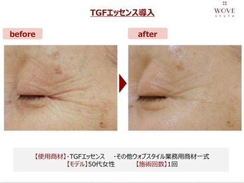 ブリエ/美容皮膚科監修エステ美顔導入器