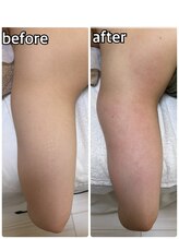 ルネ(Rune)/二の腕もスッキリ！