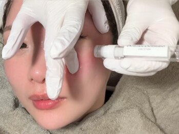 リラ ネイル クチュール(Rela nail couture)の写真/【韓国発のマイクロニードル】角質層に届ける次世代アプローチ◎新感覚の微細針で叶える本格肌ケア★