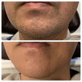 メンズレオ(Men’s Leo)