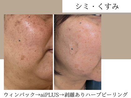 サロン アンネ(Anne)の写真