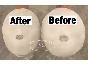 美極 トータルビューティー(美極 TOTAL BEAUTY)/恵比寿/小顔コルギ/エステ/