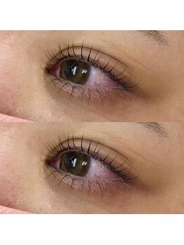 ネイルアンドアイ ビューティーオーブ(nail&eye beauty ORB)/ケラチンラッシュリフト上下